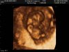9-weeks-fetus-4_14.jpg