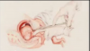 partial-birth-abortion1.png
